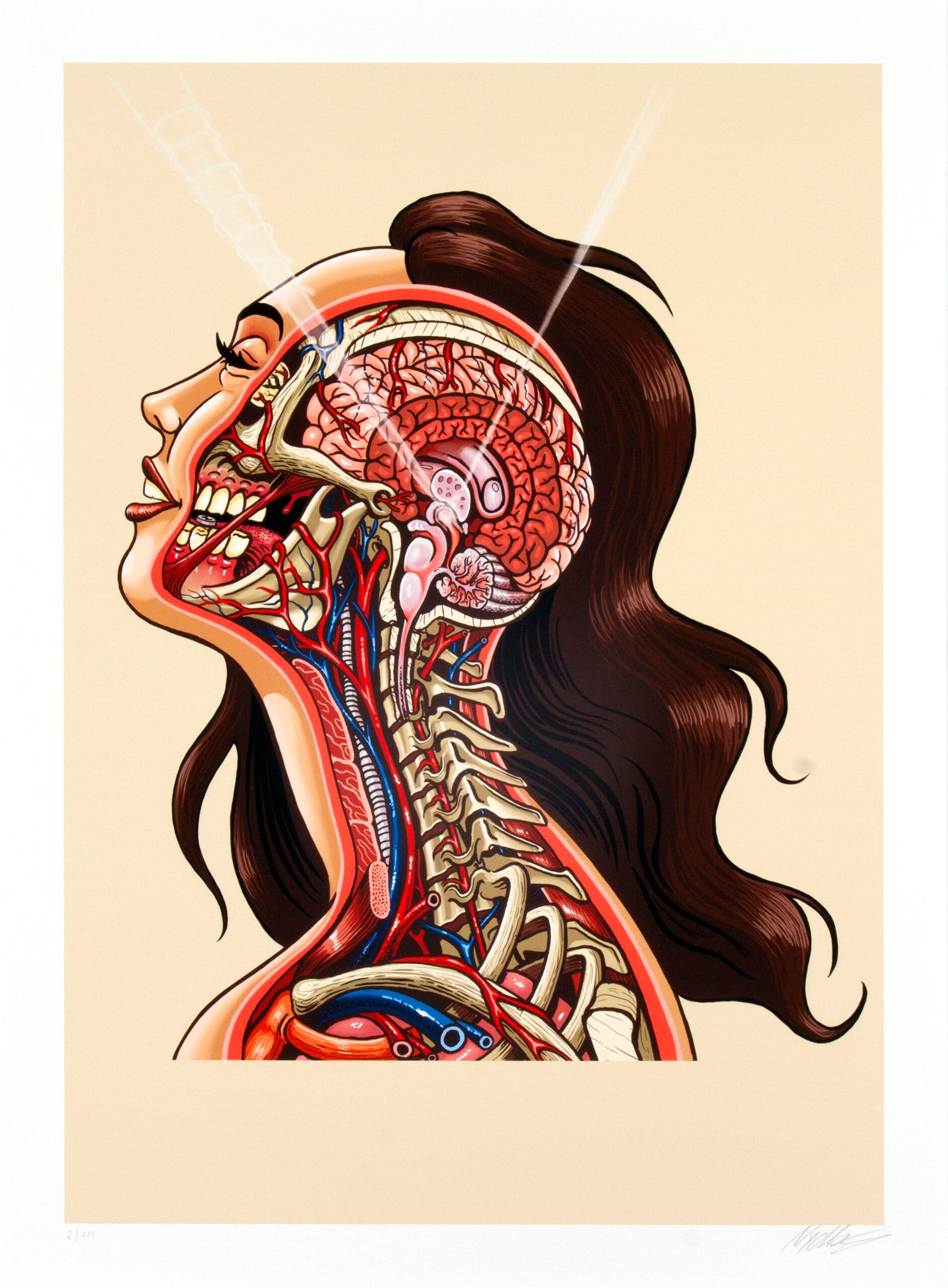 Pineal Gland
